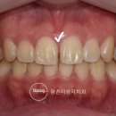 평촌심미치과의원 이미지