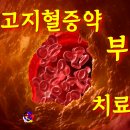 사암침, 사암침법 - 고지혈증약 부작용 치료 방법 - 비과학적 양의학 132 이미지