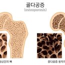 피네테스 이미지