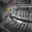 호평나무치과의원 이미지