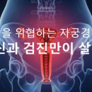 여성을 위협하는 자궁경부암, 백신과 검진만이 살 길! 이미지