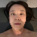 에스알 - 광주시 | [서산피부관리]예천동 수기&기계 관리 홍조,여드름 물방울리프팅 맛집 / 에스알뷰티 후기