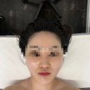대명산소 | 대구남구 작은얼굴 웨딩윤곽케어 후기 라플러스에스떼