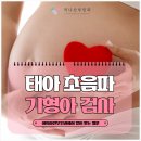 대덕종합중기 | 태아 초음파와 기형아 검사, 여의사진료 산부인과에서 많이 받는 질문까지