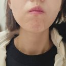 피부미애