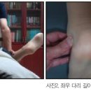 정골 이미지