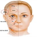 안면유지인대관리법(메디컬회춘요법)--2017년6월25일 (종료) 이미지