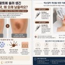 고운빛의원 네이버블로그