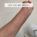 펜화 / 강좌번호 29 | 임신 소양증 접촉성피부염 임산부 비판텐 연고 병원처방 치료 해결방법