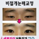 예쁜미인성형외과 이미지