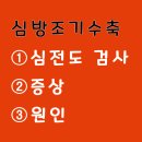 (펀글)심방조기수축 부정맥 심전도 검사 보는 방법 뜻 증상 원인 (with 스마트 워치) 이미지