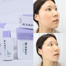 영크리닝 | 리쥬란 더마 힐러 포어 타이트닝 올리브영 론칭 ! 피부 모공 관리 추천 패드 ,앰플 2종 후기