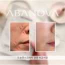 드뉴 이미지