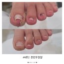 천안내성발톱 발관리 레푸스 천안두정점 방문후기