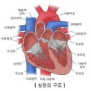 심방 세동 (Atrial Fibrillation) 이미지