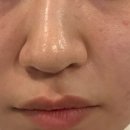 라르떼의원 네이버블로그
