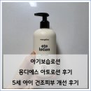 아토 | 몽디에스 아토로션 후기 5세 아이 아기보습로션 추천 건조피부 개선 후기