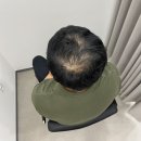 오하이스칼프