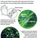 Covid’s Heart Damage Is Shown to Linger 이미지