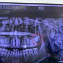 사랑니톡앤턱치과의원 이미지