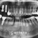 청주으뜸치과 이미지