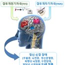 항우의료기기 | 디지털치료제와 전자약에 의한 의약 산업의 패러다임 전환 ㉘ - 약사신문