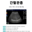 셀빙강내과의원 네이버블로그