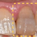 수원탑플란트치과의원 이미지