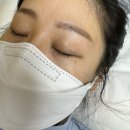 수원 율전동 뷰티케이 무통증 잔흔제거 3차후기