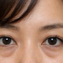 더노블성형외과의원 이미지