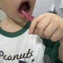 유일유치원 | 유치원 양치 준비물 래디어스 토츠 칫솔 써본 솔직 후기