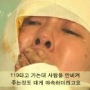 황산테러 당한 26세 정아씨 총 치료비만 1천만원 '시급' 이미지