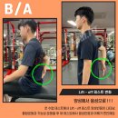 리 펑셔널 퍼스널 트레이닝 | 수업 1회 만에 어깨 기능 회복, 수성1가 리펑셔널 재활 트레이닝