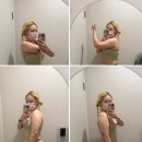 OK큐병원 화장실 | [내돈내산] 제로클리닉 강남 지방분해주사 리얼후기 마지막 5회차