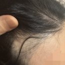 신주프라자 | 내돈내산_두피문신 리터칭 후기 (2편)