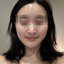 MY이솝 | 평촌 피부관리 위뷰티 평촌점 광대축소 마사지 16회차 후기