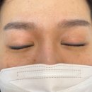 울산 삼산동 앰플제거로 눈썹 잔흔 지우기 :: 시옷브로우