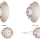 아이디안경 이미지
