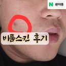 비룸스킨