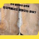 피부관리숨앤결