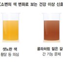 진한색소변 당뇨 소변 붉은 소변 어떤 문제일까? 이미지