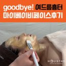 [홀리스떼생생후기] 여드름흉터 없이 세상 예쁜 내 피부 마이베이비페이스 리얼후기