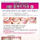 e-플랜트치과 이미지