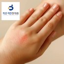 손발발라