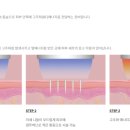 (주)피치메디컬 이미지