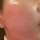 예다움피부관리실 | 산본 피부관리 / 산본 피부관리실 - 예다움 피부관리 뱀부테라피 후기