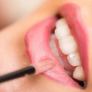 365서울채움치과의원 이미지