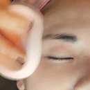 강남대로6-2-LED | [강남 보름달뷰티]여드름 블랙필 압출 관리! 가격, 효과 후기