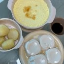 우주사 | 허벅지지방추출주사 세달차 변화 솔직후기