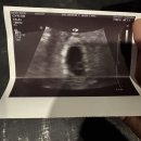 파크병원 | [공지] 장산역 퀸즈파크여성병원 1인실 제왕절개 출산후기